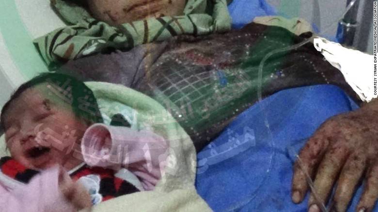 Syrian baby born with shrapnel on forehead
