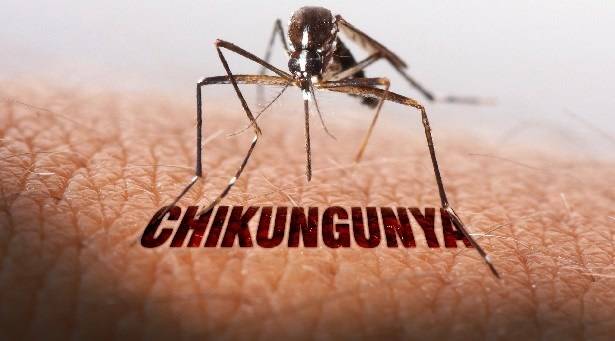 Everything you need to know about Chikungunya fever