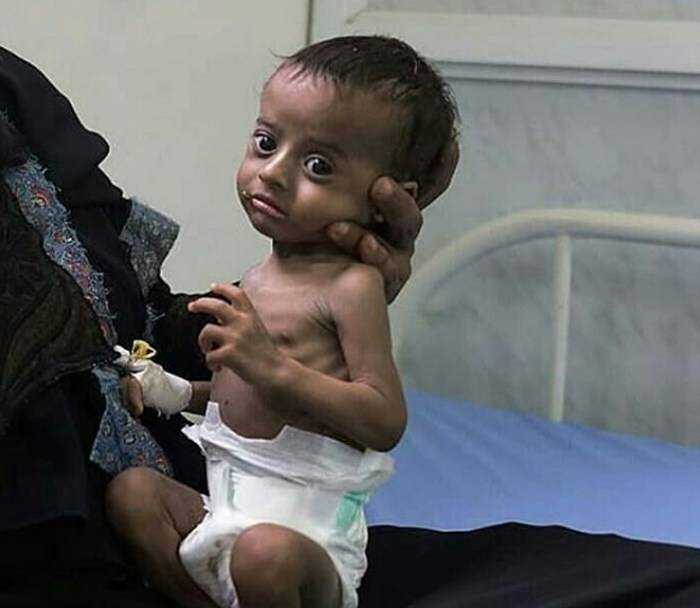 Yemen faces worsening threat of famine: UN aid chief