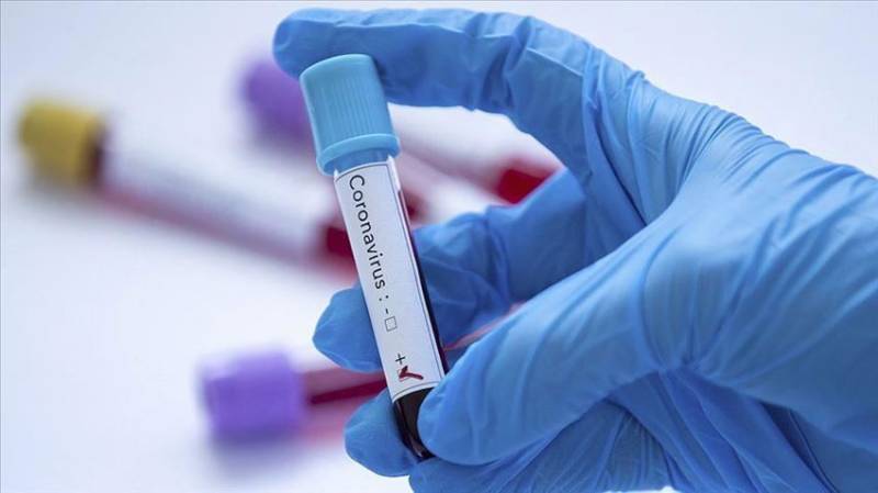 Govt sets up coronavirus testing laboratories to meet 30,000 tests per day: Asad