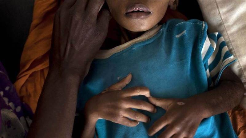 Woman, 2 children die of hunger in Somalia as drought worsens