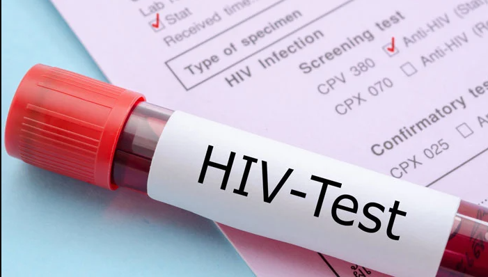 40 new HIV cases reported in Pakistan