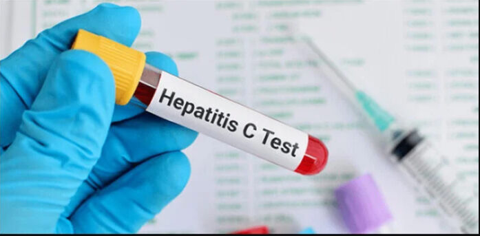 Govt decides to conduct Hepatitis C screening across Pakistan