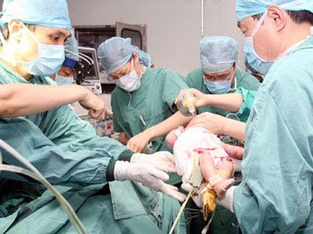 China hospital separates conjoined twins