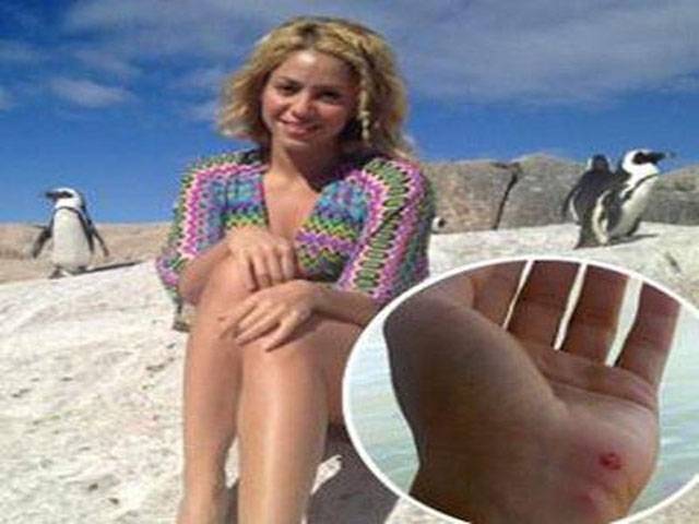 Shakira attacked by sea lion