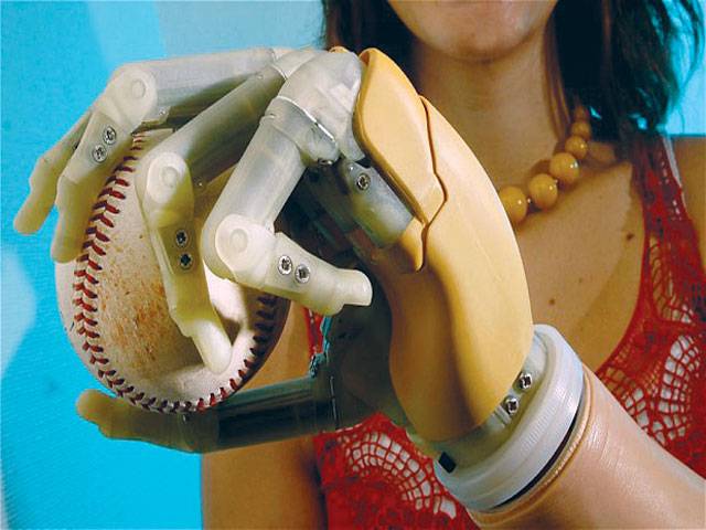 Woman wants hand removal for bionic replacement
