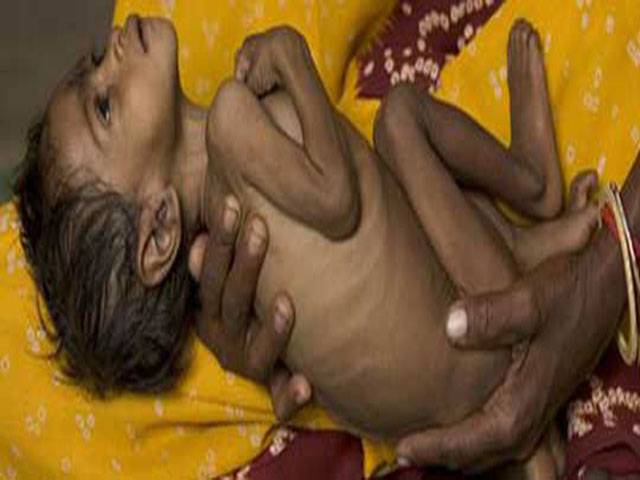 India’s malnutrition problem - a systemic issue