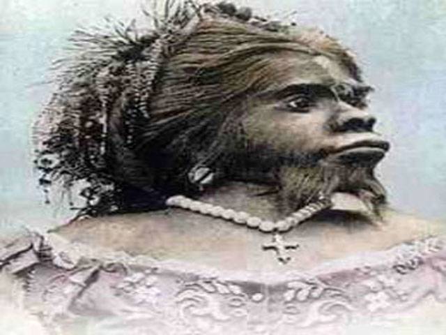 ‘Ugliest woman’ buried after 150 years