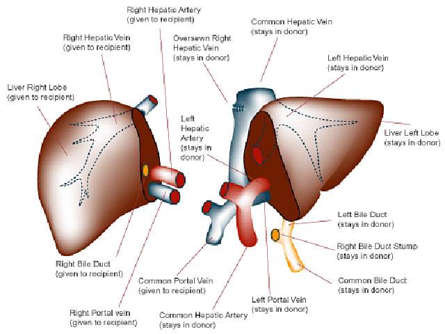 ‘Around 300,000 need liver transplant'