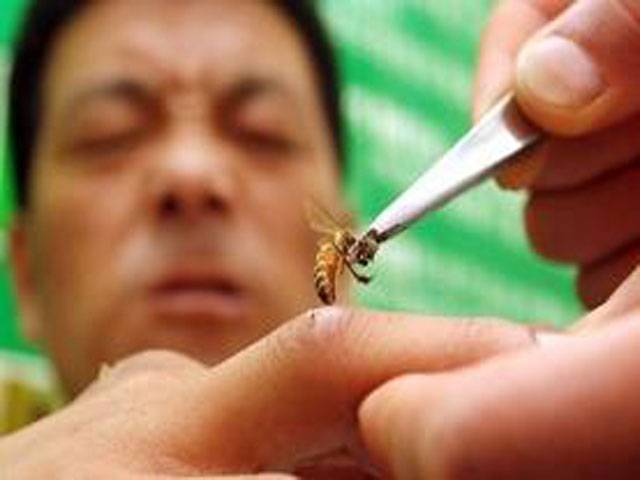 Bee sting therapy causing a buzz in China 