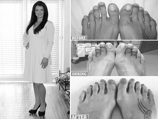 Women altering size, shape of feet for heels