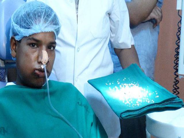Doctors remove 232 teeth from boy’s mouth