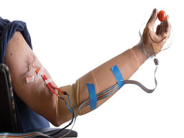 Bionic arm restores sense of feeling
