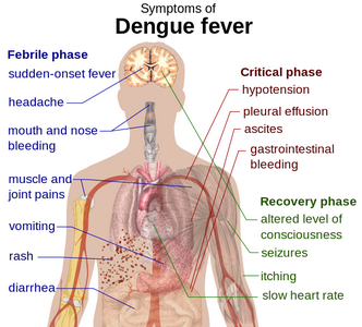 Defeating dengue fever