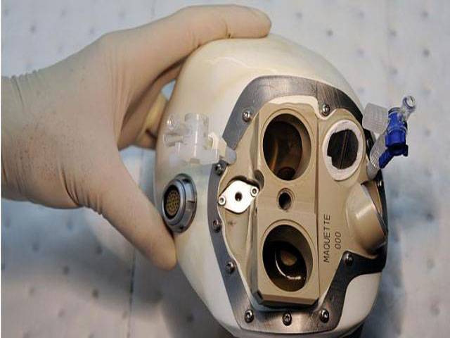 France’s 2nd artificial heart recipient ‘recovered’