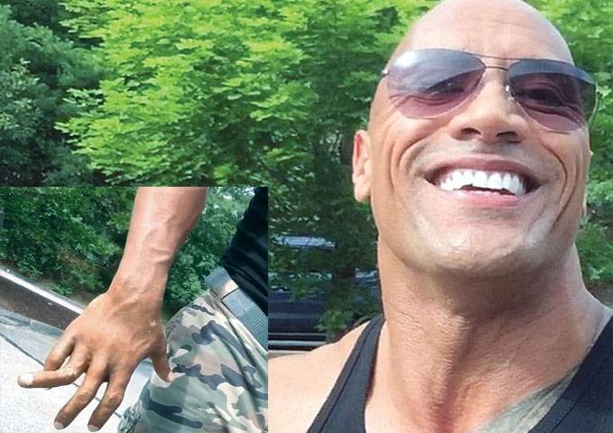 The Rock shares Instagram video of twisted finger 