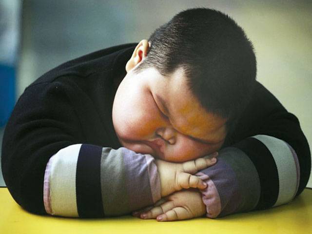 Child obesity a nightmare in developing world 