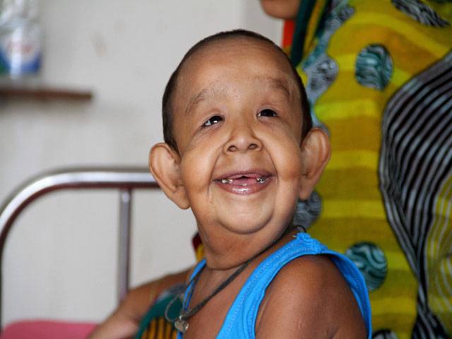 Bangladeshi boy with ‘old man’ illness baffles doctors