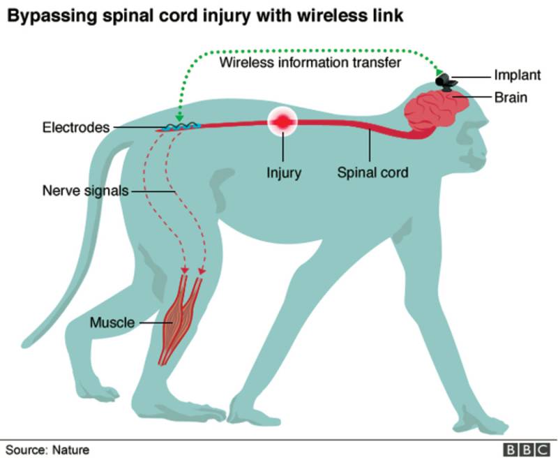 Paralyzed monkeys walk again with wireless ‘brain-spine interface’