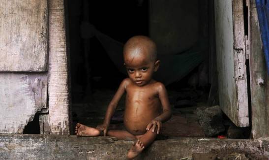 Stunted children of South Asia