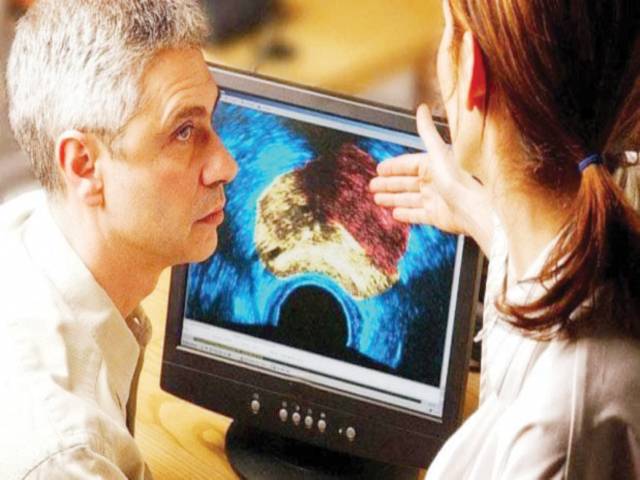 Prostate biopsies could be avoidable with MRIs