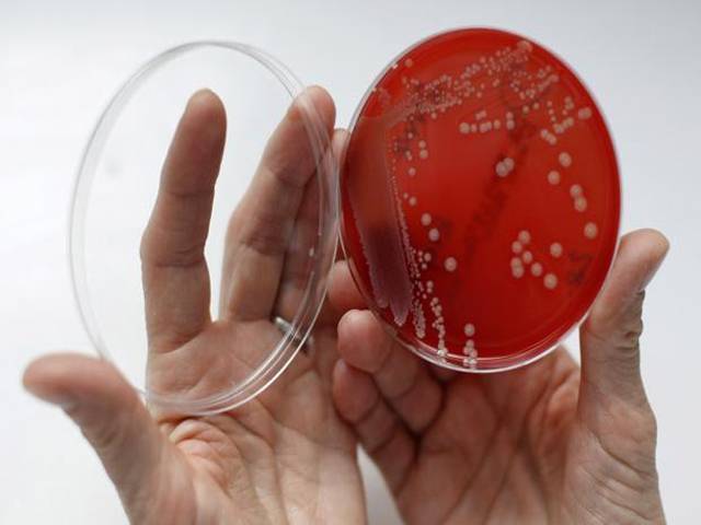 ‘Alarming’ superbugs a risk to people, animals and food