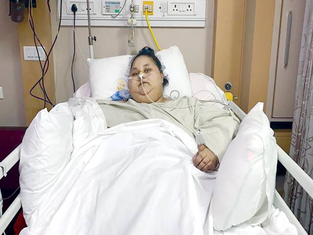 ‘World’s heaviest woman’ loses 100kg after surgery