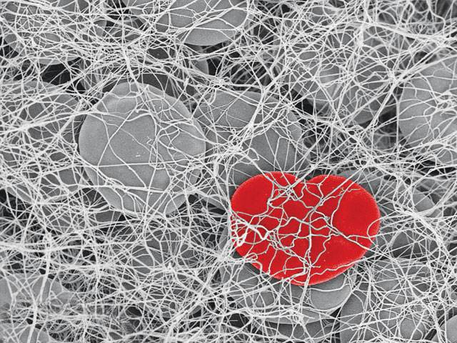 Image of a heart-shaped cell wins BHF's photo contest 