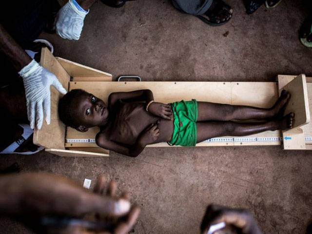 400,000 children in DR Congo could die from hunger: Unicef