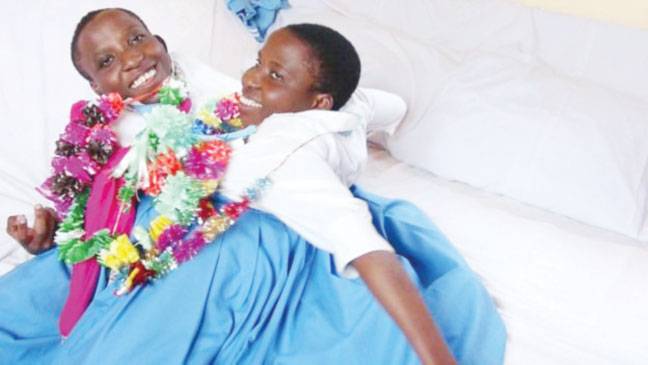 Tanzanian conjoined twins die aged 22