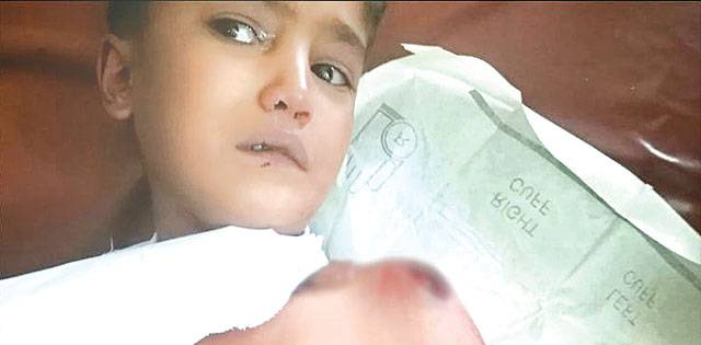 Boy injured in Indian firing