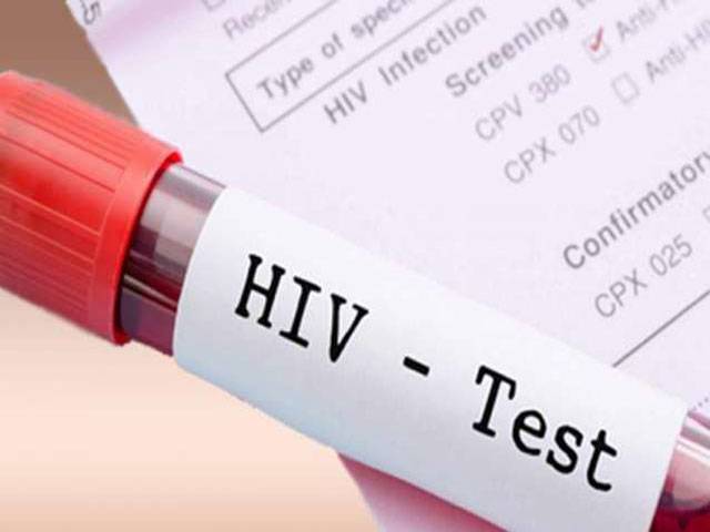 Russia succeeds in stopping HIV spread 