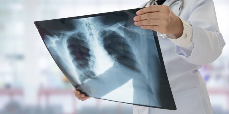 250 people die each day from TB in Western Pacific region