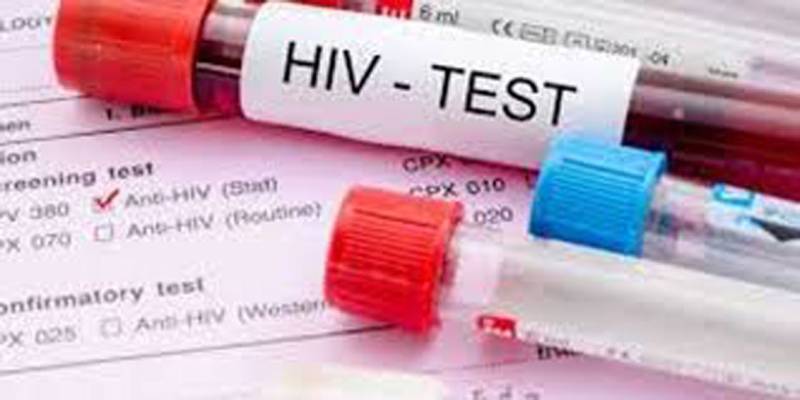 Number of HIV-positive cases increases