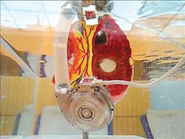 China’s indigenous ‘artificial heart’ saves two