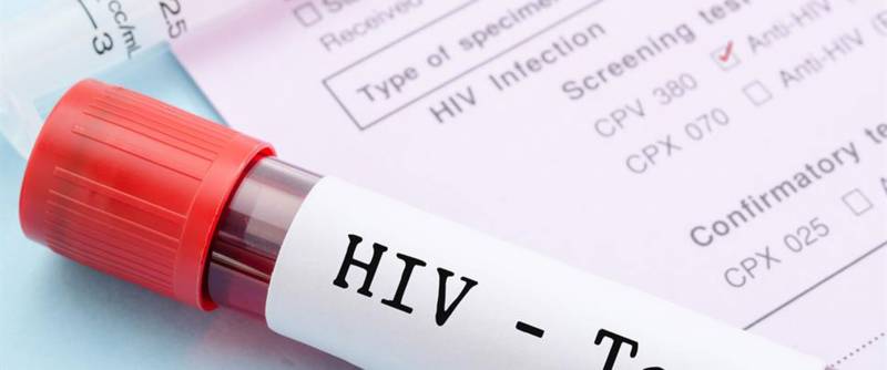 Free HIV screening