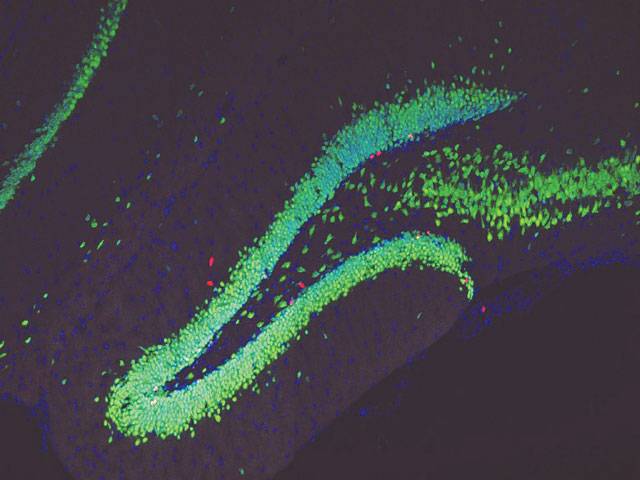 Antidepressant power of lactate revealed in new research