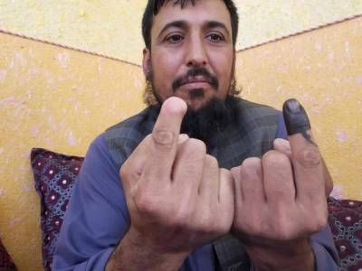 Taliban cut off his finger for voting, he defied them again